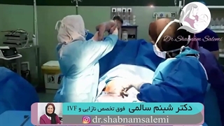 زایمان سزارین دوقلویی