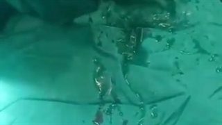 سزارین سه قلویی در ساعت 1 بامداد