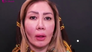 عمل حجم دهی دائم لب بالا