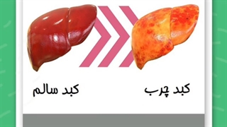 صحبت های دکتر طاهری درباره کبد چرب (پارت اول)