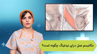 مکانیسم عمل دراى نیدلینگ چگونه است؟