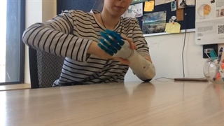 تست دست مصنوعی شرکت Esper Bionics