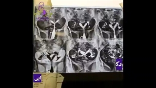 جراحی لاپاراسکوپی و هیستروسکوپی