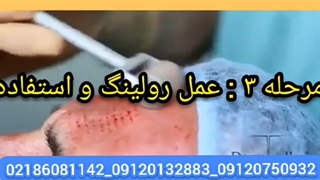 درمارولر اصل/۰۹۱۲۰۷۵۰۹۳۲/درمارولرzgts