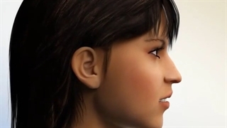 درمان لبخند لثه ای با جراحی فک | دکتر احسان مهریزی