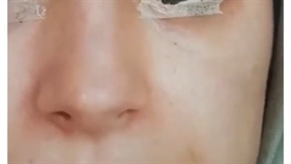 فیلم جراحی بینی یک دختر