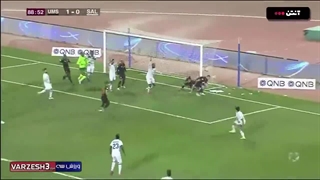 روزبه چشمی رفع افتادگی پلک