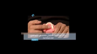 دستگاه های ارتودنسی / متخصص ارتودنسی / دکتر جمیلیان