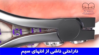 ناراحتی ناشی از انتهای سیم | دکتر احسان مهریزی