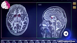 محصول ترک خودارضایی