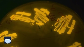 نکاتی ساده برای محافظت در برابر ابرباکتری‌ها