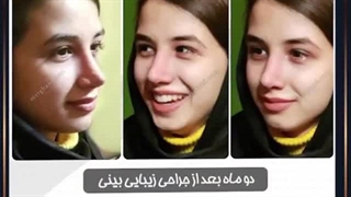 نمونه کارهای دکتر علی میقانی