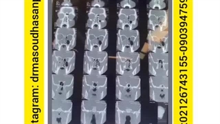 تماشای فیلم جراحی پولیپ قارچی توسط بهترین دکتر متخصص گوش حلق و بینی