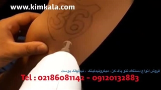 دستگاه تتو پاک کن 09120132883