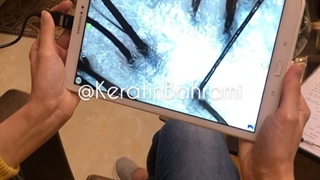 اسکراب اسکالپ