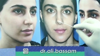 فیلم فوق العاده جراحی بینی