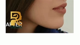 جراحی زیبایی بینی