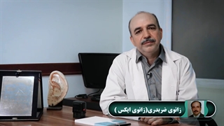 زانوى ضربدرى(زانوى ایکس)