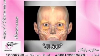دکتر علیزاده بهترین دکتر تزریق چربی در تهران آر اف فرکشنال