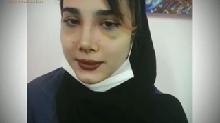 نتیجه عمل زیبایی بینی