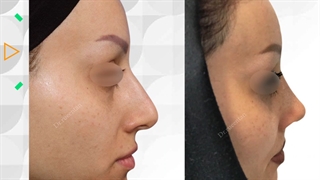 عمل زیبایی بینی | فوق تخصص جراحی پلاستیک | دکتر عبدالرضا روئین تن