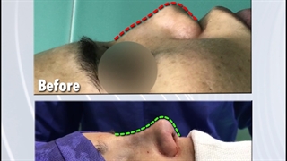 جراحی زیبایی بینی | فوق تخصص جراحی پلاستیک | دکتر عبدالرضا روئین تن