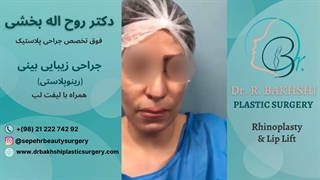 جراحی بینی دکتر بخشی