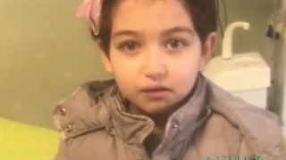 نتیجه ترمیم دندان کودک