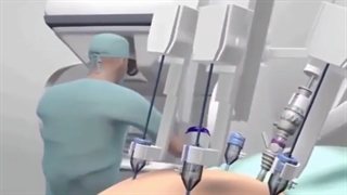 فیلم جراحی گاستریک بای پس