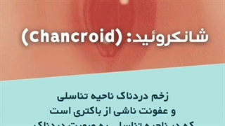 عفونتهای منتقله از راه جنسی