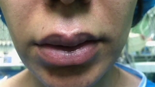 تخلیه ژل بیوپلیمر لب