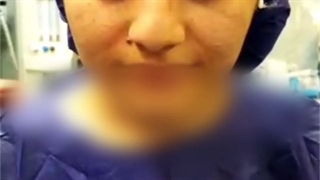 جراحی بینی گوشتی