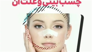 چسب بینی و علت آن