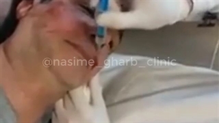 سابسیژن