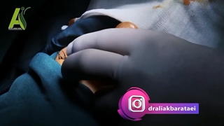فیلم اتاق عمل جراحی بینی - قسمت اول