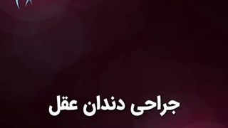 جراحی دندان عقل