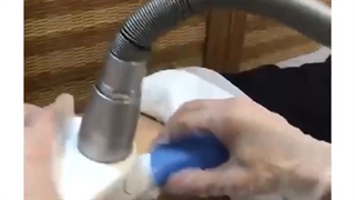 نتیجه عالی از اگزیمیا شکم پهلو برای لاغری موضعی