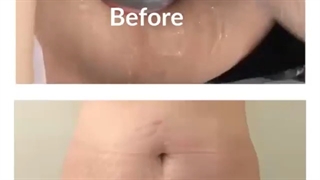 رضایت مراجعه کننده عزیزمون از دستگاه اگزیمیا