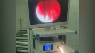 جراحى انسداد مجراى اشکى با آندوسکوپی