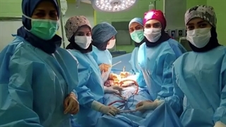 هیسترکتومی رحم بزرگ و فیبروم های متعدد