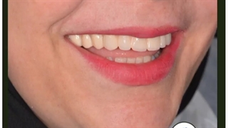 جراحی و ایمپلنت دندان