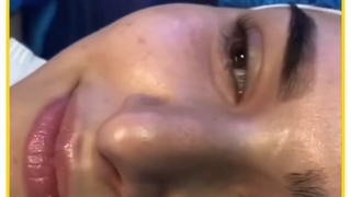 عمل زیبایی بینی