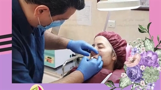 رفع گودی زیر چشم