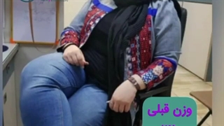 مزایای عمل اسلیو معده