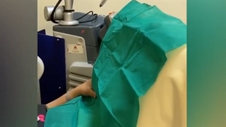 رضایت مراجعه کننده عزیز از عمل لابیاپلاستی با لیزر مونالیزا بدون درد و خونریزی