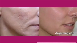 قوی ترین کرم سفید کننده صورت/۰۹۱۲۰۷۵۰۹۳۲/قوی ترین کرم ابریشم