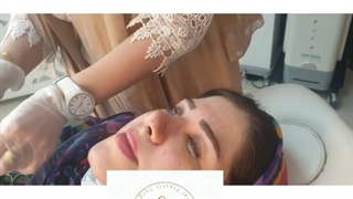 فیلم یک هفته بعد از جراحی بینی گوشتی