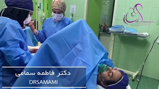 سزارین بعد از پارگی کیسه اب