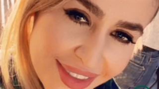 نمونه عمل بینی از دکتر نصیبه رستمی