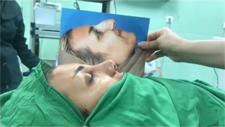 نمونه جراحی بینی از دکتر نصیبه رستمی